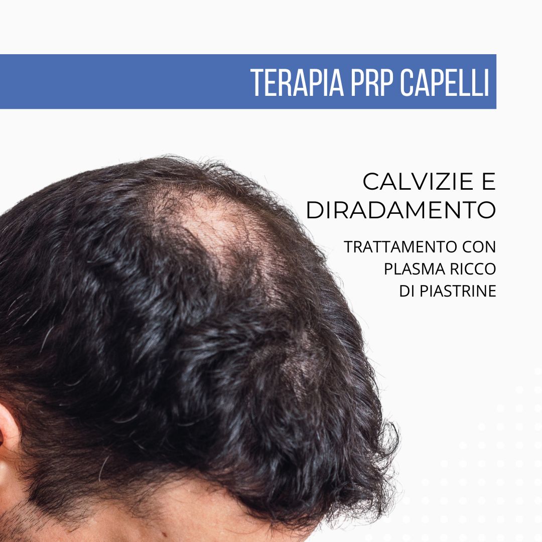 Calvizie e diradamento